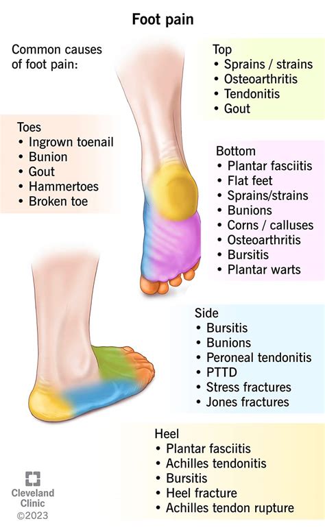 feetp|Foot pain Causes .